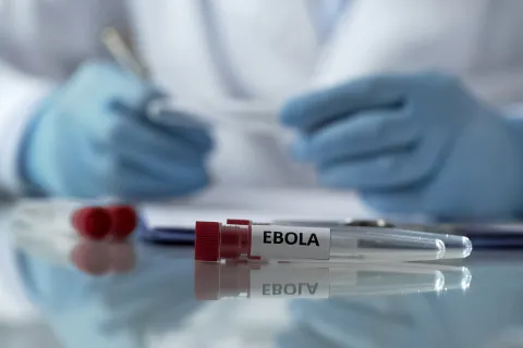 ebola sample in lab