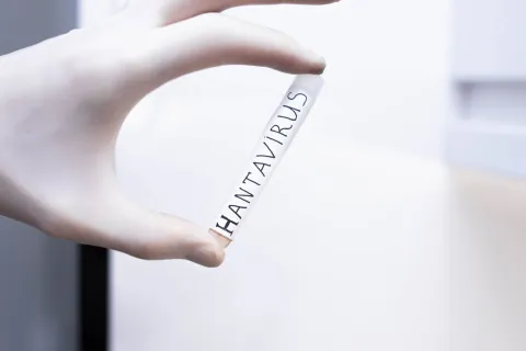 hantavirus